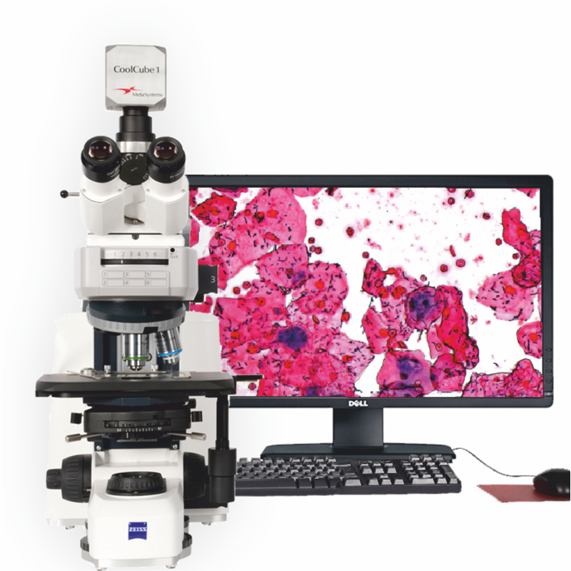 Gram Stain Analysis Automated Digitization of Gram Stains
