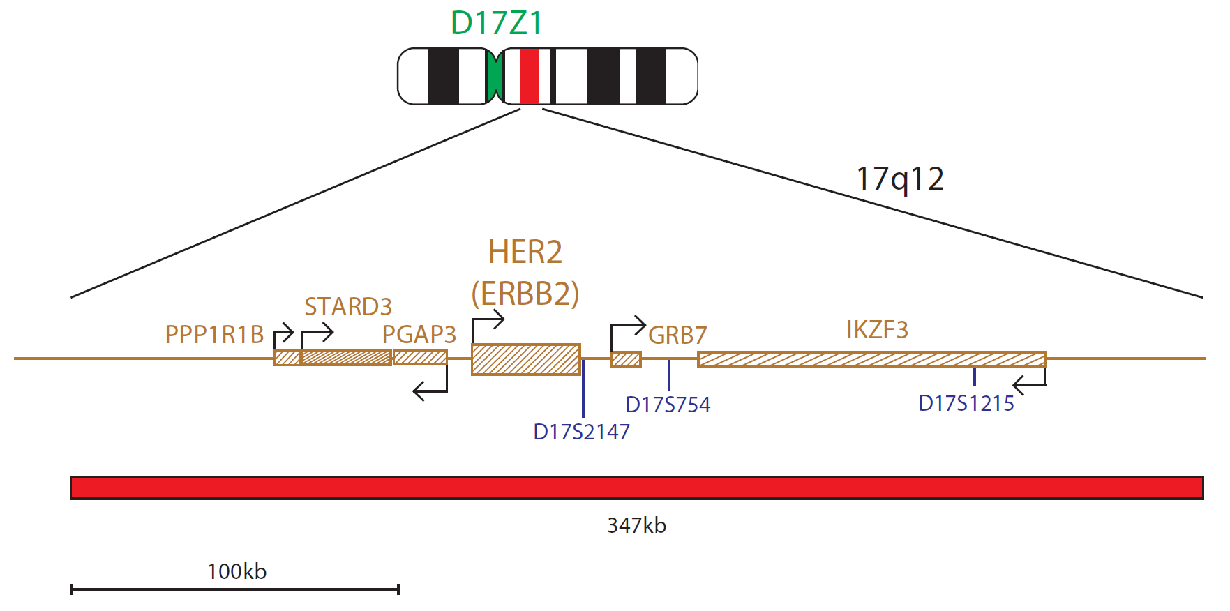 HER2 (ERBB2) Amplification