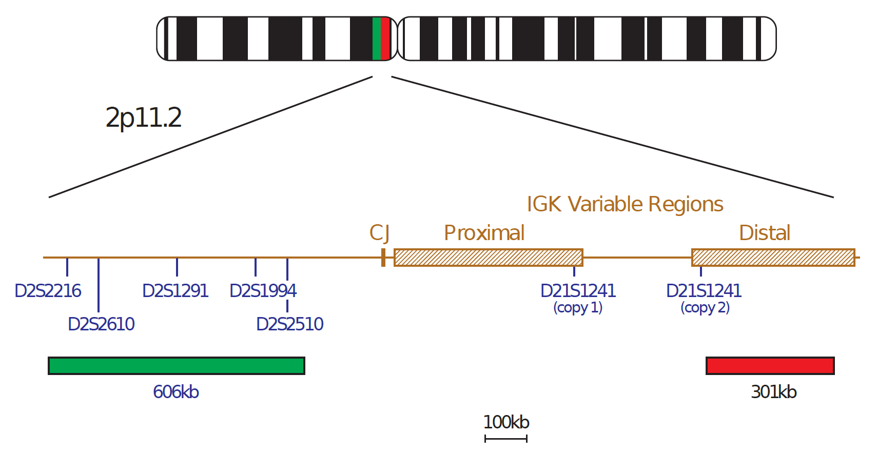 IGK Breakapart