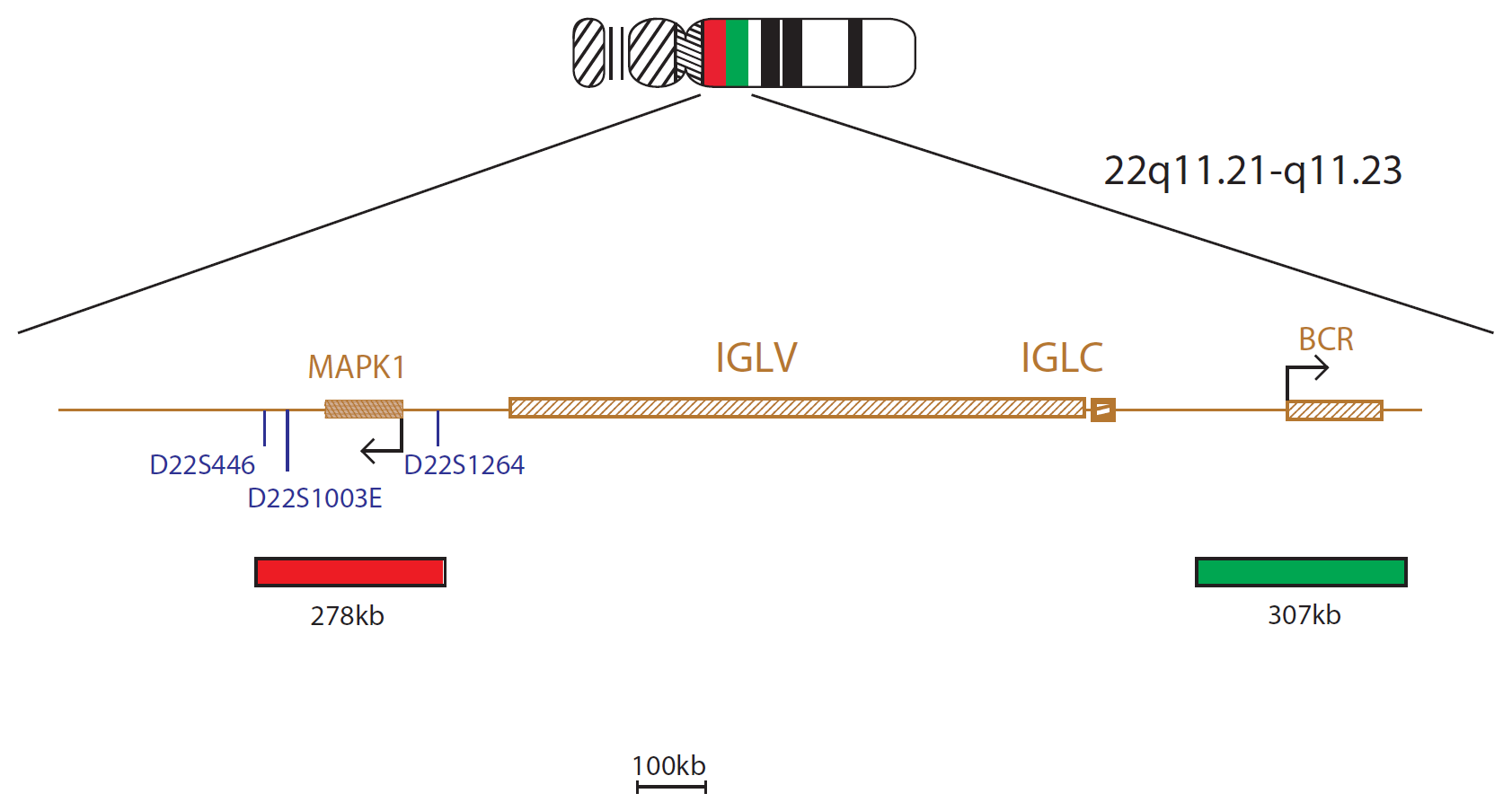 IGL Breakapart