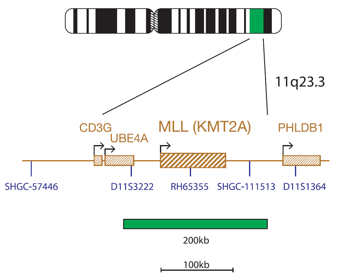 MLL (KMT2A )/AFF1 Translocation