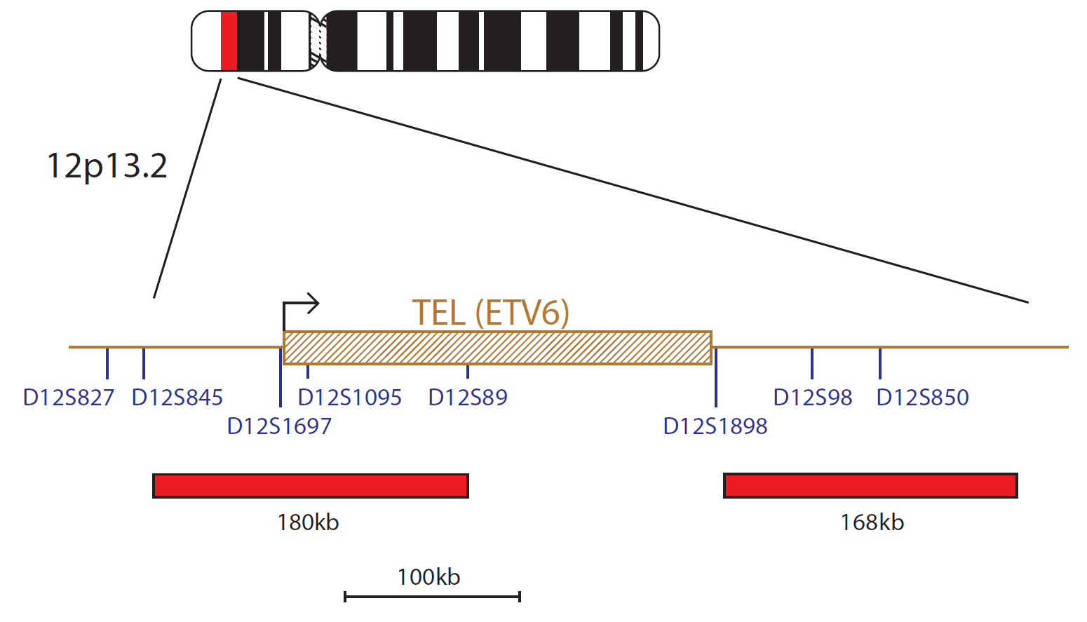 TEL/AML (ETV6 / RUNX1) Translocation